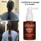 Soulflower Hair Growth Serum, Rosemary Oil, 3% Redensyl, 4% Anagain, Caffeine, Melanogray, Biotin, Rice Water, Clinically Tested on Real people, Hair growth & Hair fall control for Women & Men | 30ml