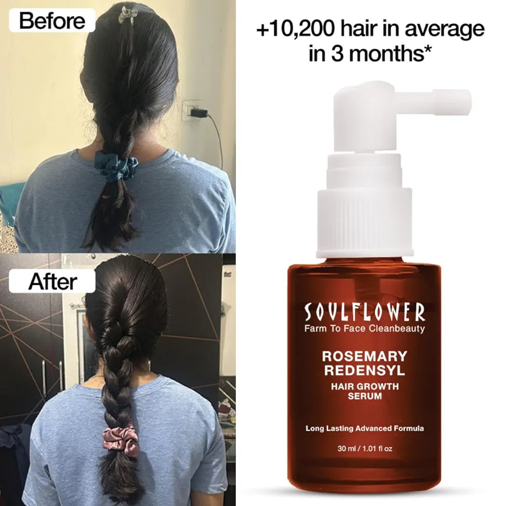 Soulflower Hair Growth Serum, Rosemary Oil, 3% Redensyl, 4% Anagain, Caffeine, Melanogray, Biotin, Rice Water, Clinically Tested on Real people, Hair growth & Hair fall control for Women & Men | 30ml