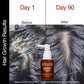Soulflower Hair Growth Serum, Rosemary Oil, 3% Redensyl, 4% Anagain, Caffeine, Melanogray, Biotin, Rice Water, Clinically Tested on Real people, Hair growth & Hair fall control for Women & Men | 30ml