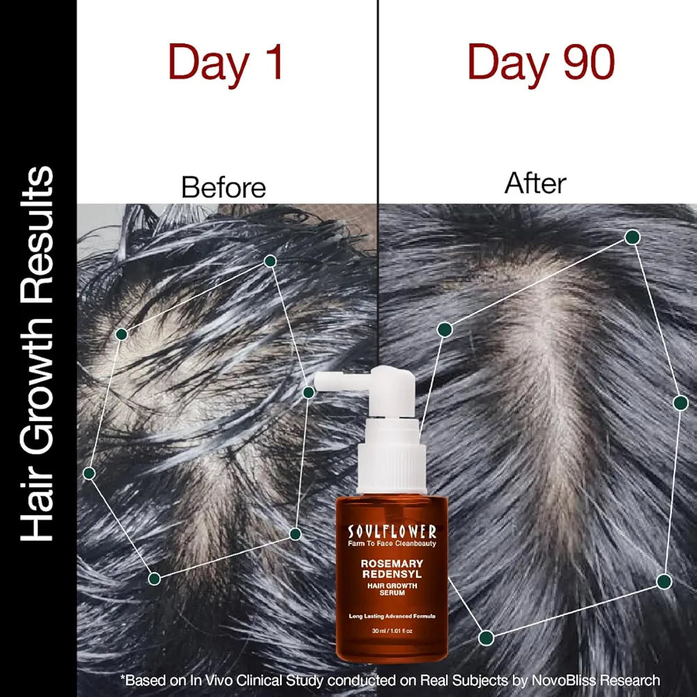 Soulflower Hair Growth Serum, Rosemary Oil, 3% Redensyl, 4% Anagain, Caffeine, Melanogray, Biotin, Rice Water, Clinically Tested on Real people, Hair growth & Hair fall control for Women & Men | 30ml